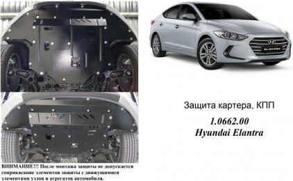 Защита двигателя КОЛЬЧУГА для Hyundai Elantra VI (AD) (2016-) 1,6GDI и 2,0 АКПП